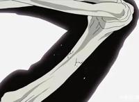 第四次忍界大战后，为什么迈特凯的脚不用柱间细胞恢复？